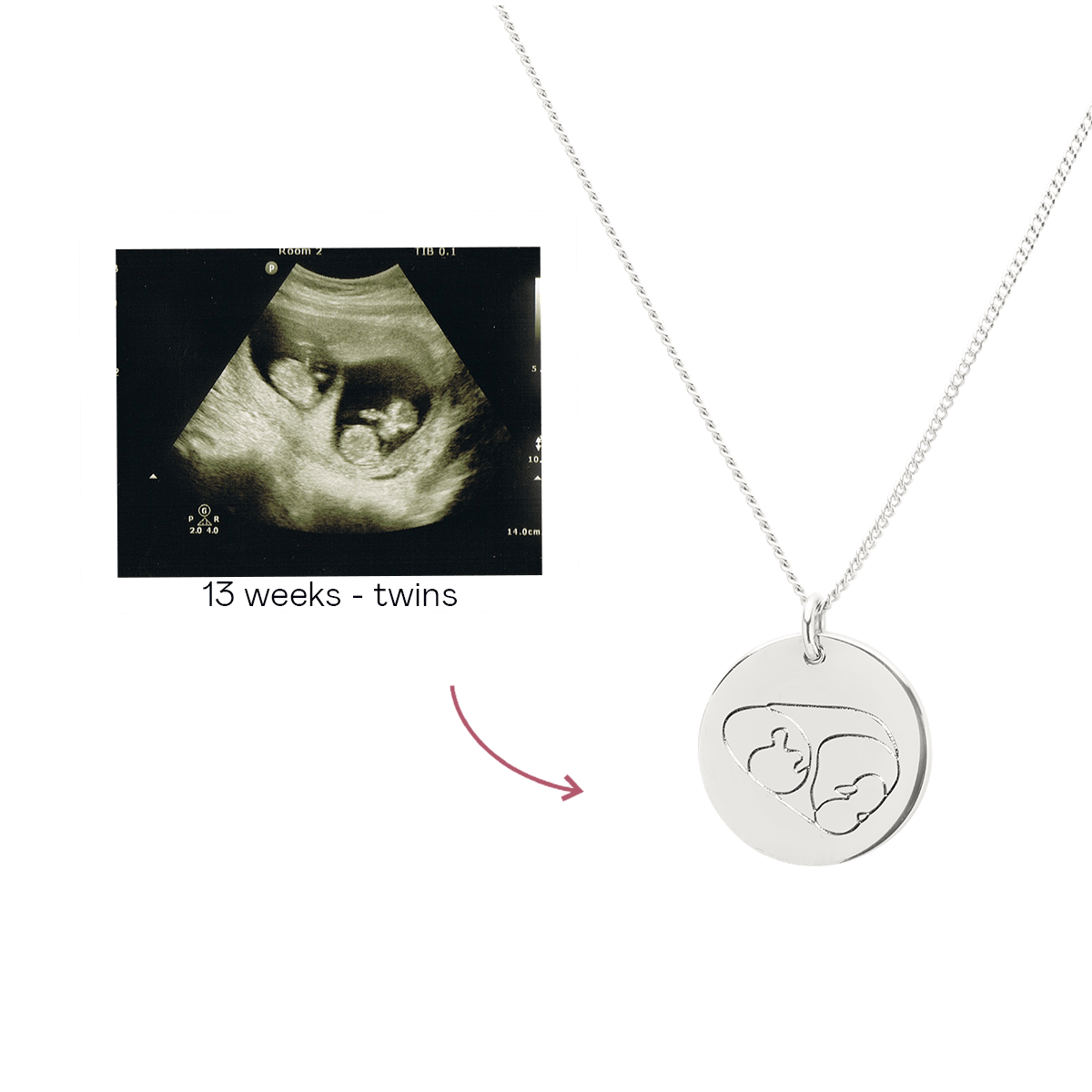 Ultrasound Line Coin Necklace Deluxe