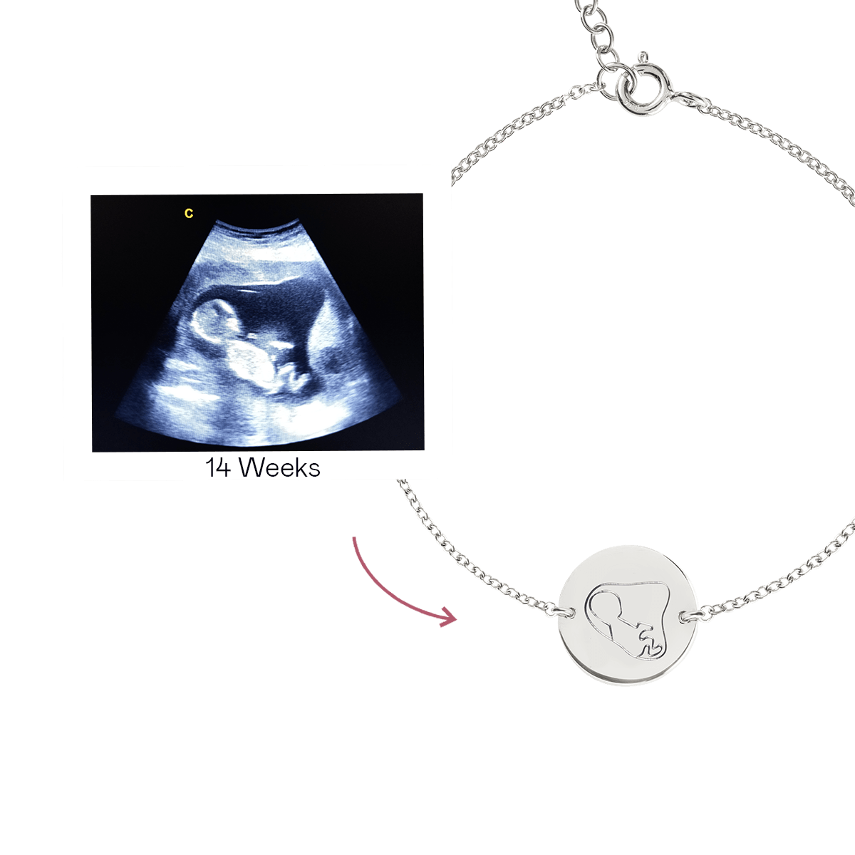 Ultrasound Line Coin Bracelet