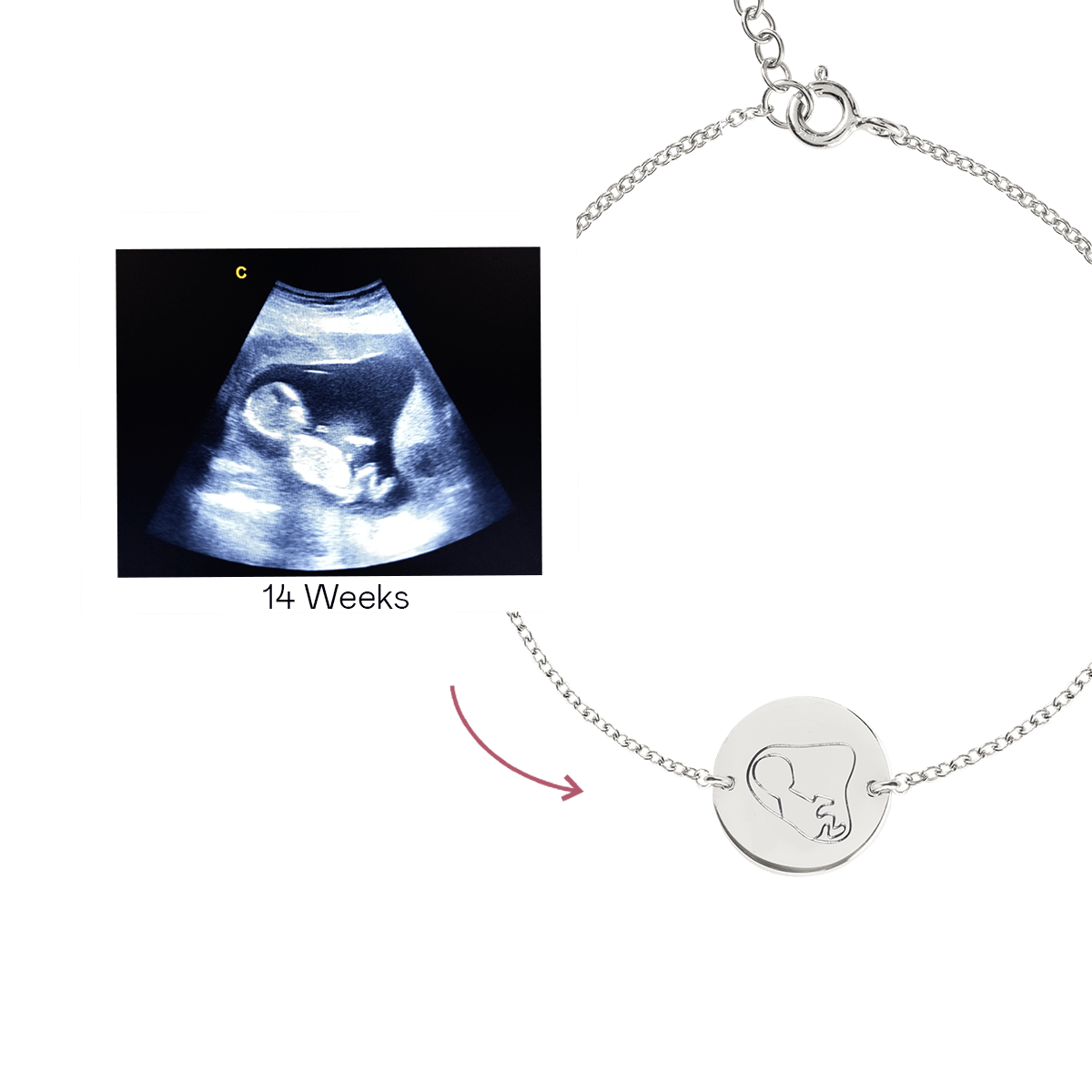 Ultrasound Line Coin Bracelet Deluxe