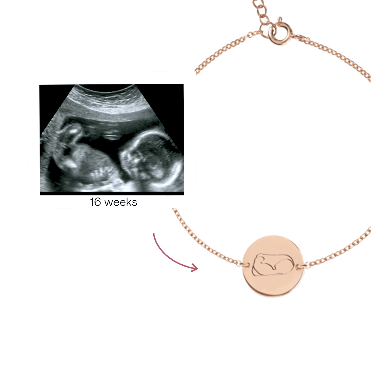 Ultrasound Line Coin Bracelet Deluxe