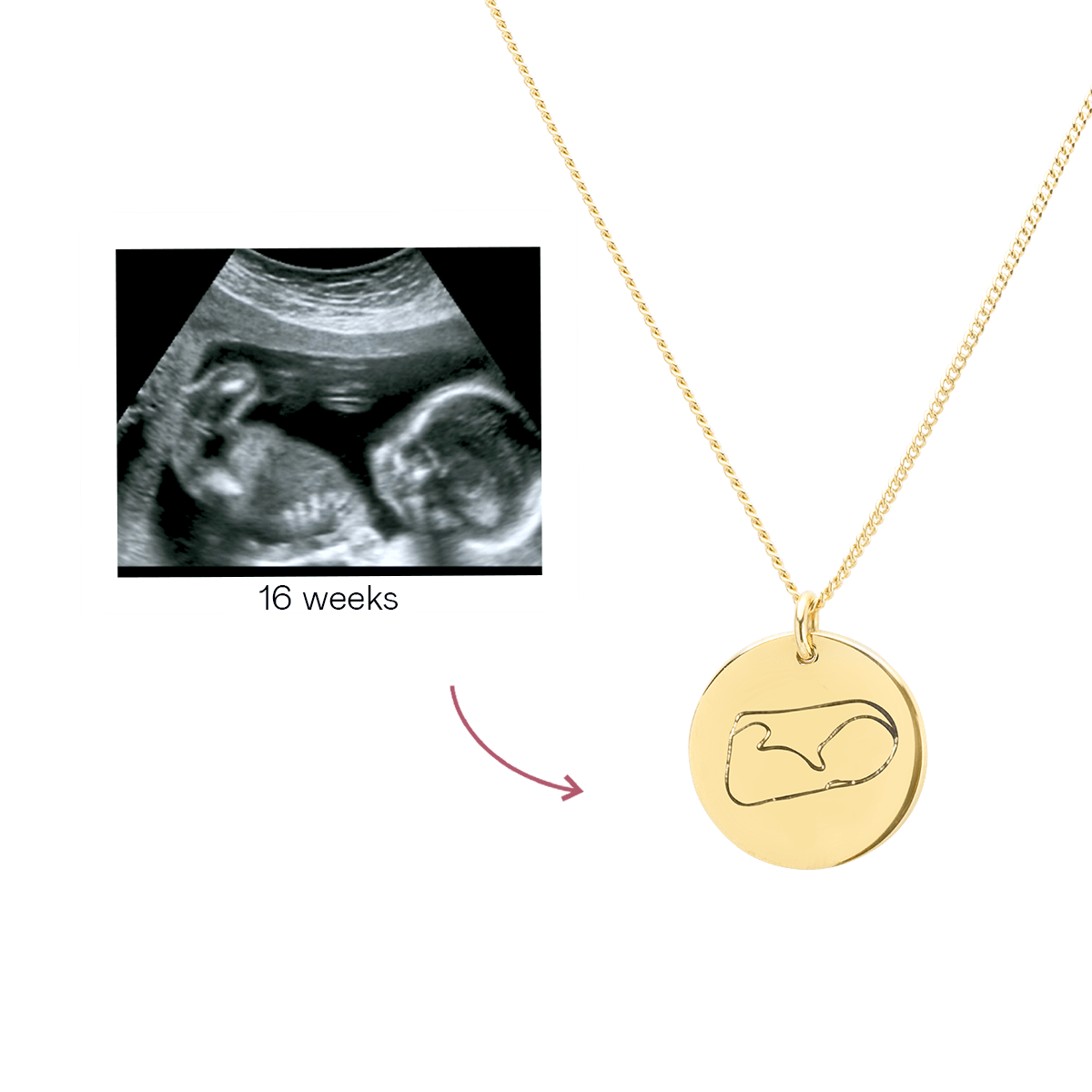 Ultrasound Line Coin Necklace Deluxe