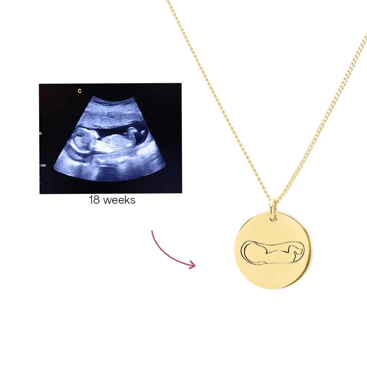 Ultrasound Line Coin Necklace Deluxe