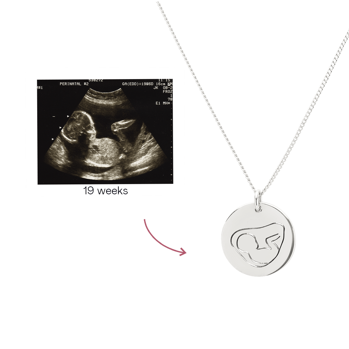 Ultrasound Line Coin Necklace