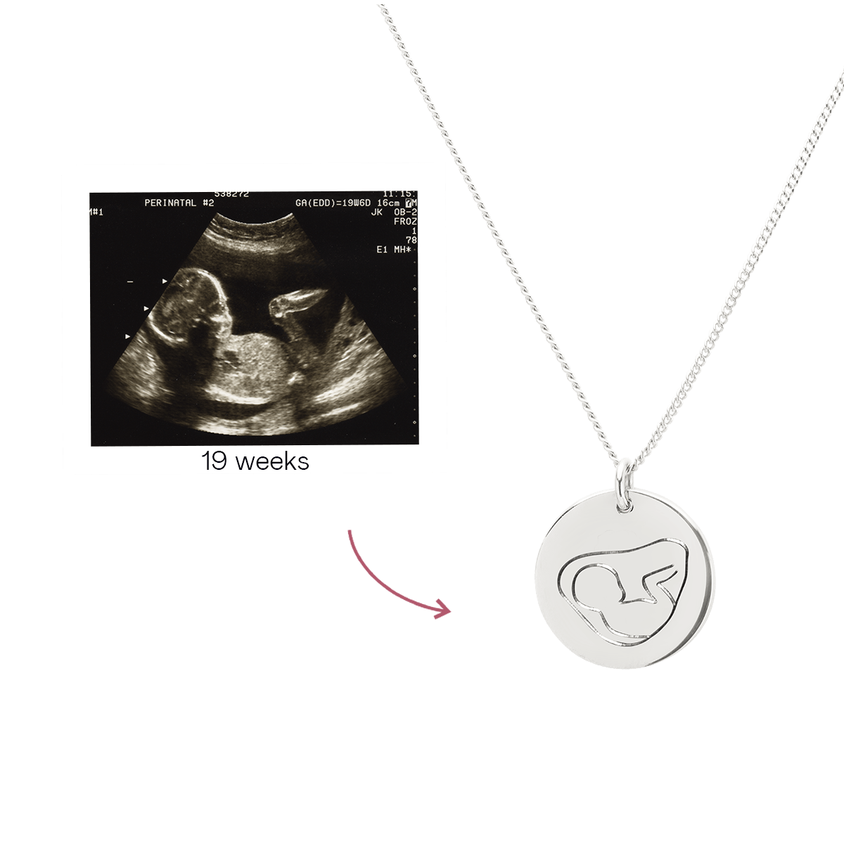 Ultrasound Line Coin Necklace Deluxe