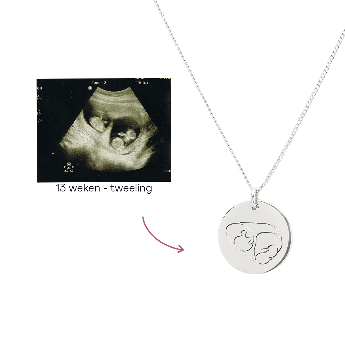 Ultrasound Line Coin Ketting