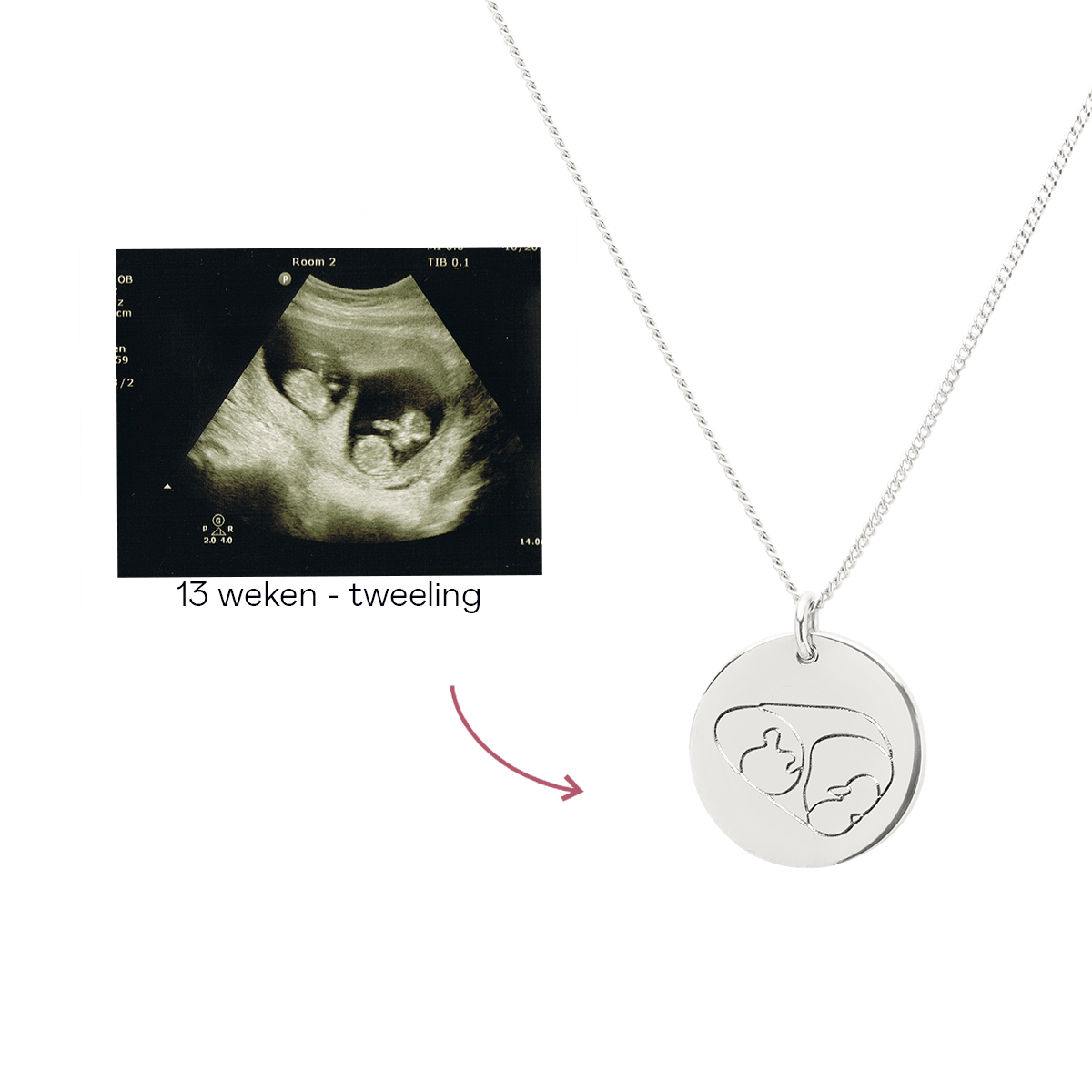 Ultrasound Line Coin Ketting Deluxe