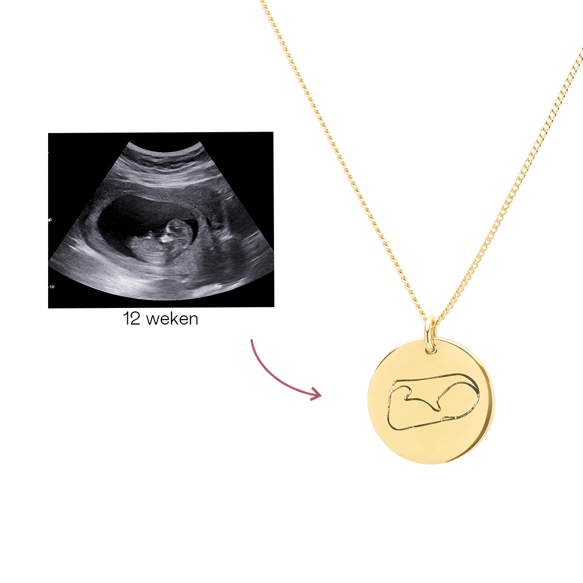 Ultrasound Line Coin Ketting