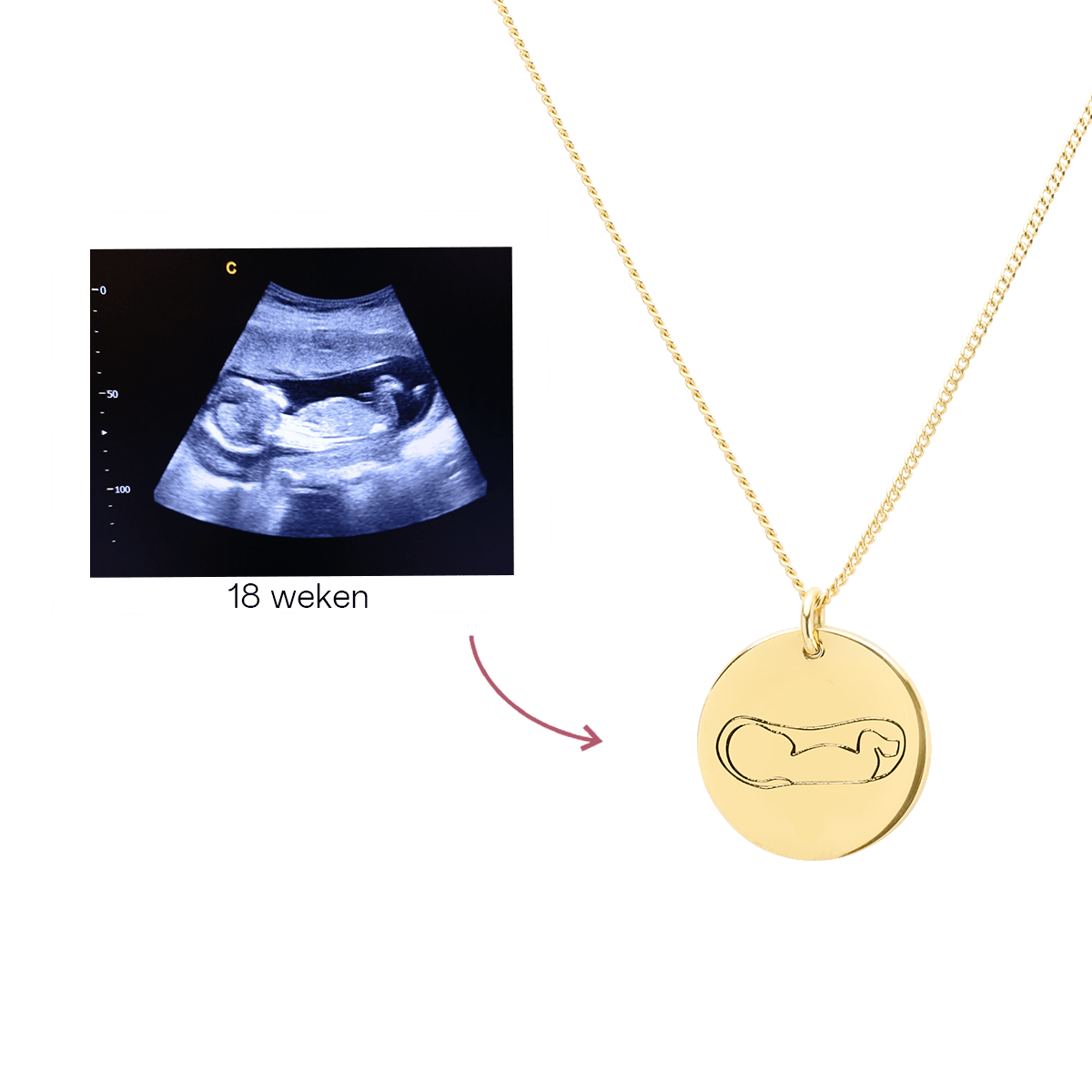 Ultrasound Line Coin Ketting