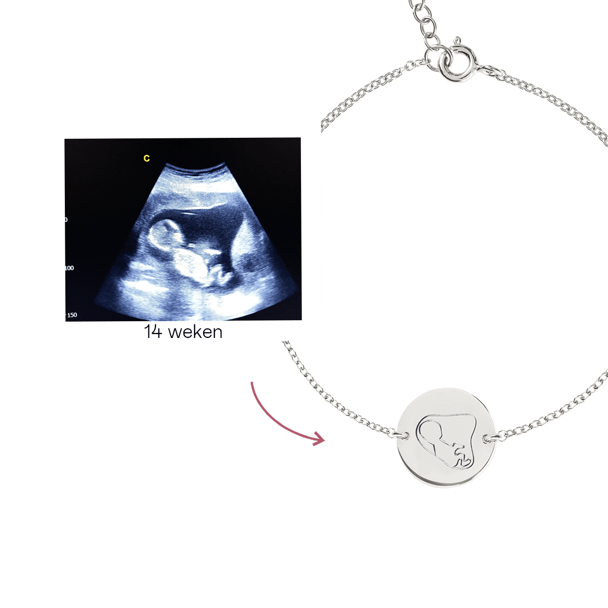 Ultrasound Line Coin Armband