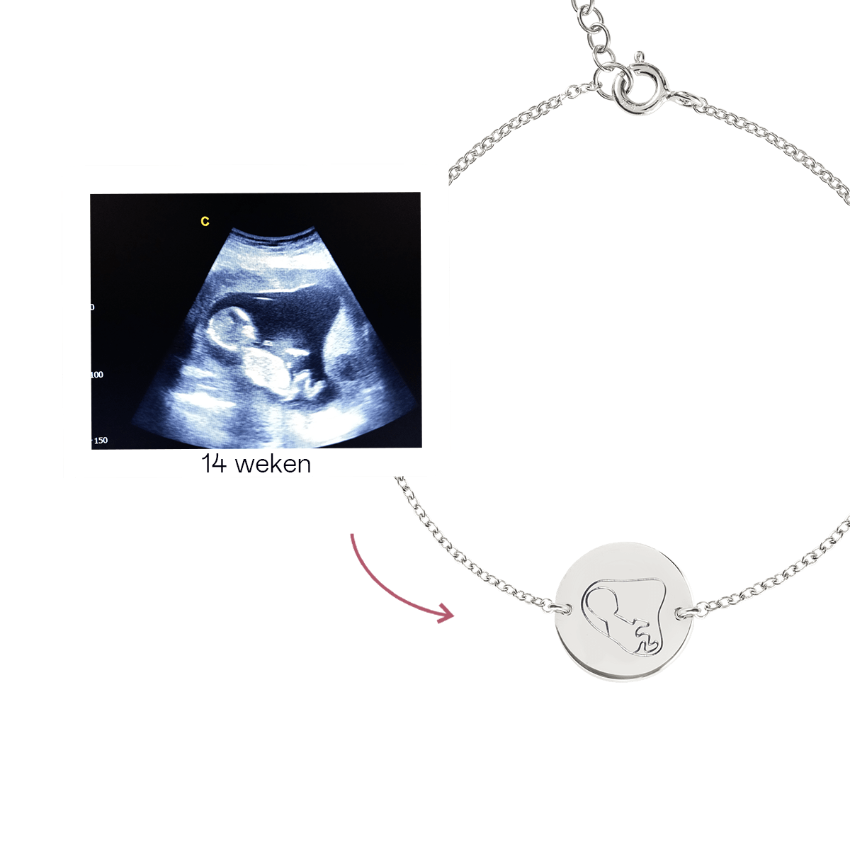 Ultrasound Line Coin Armband Deluxe
